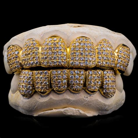 diamond grillz amazon|real diamond grillz for sale.